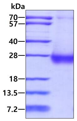 3ug by SDS-PAGE under reducing condition and visualized by coomassie blue stain.